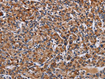 LRRC15 antibody