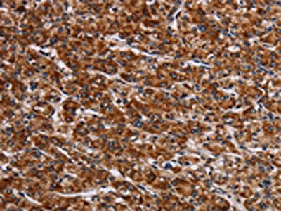 LRRC15 antibody