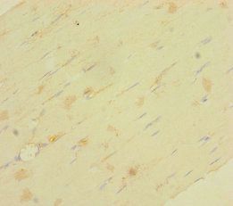 LRRC19 Antibody