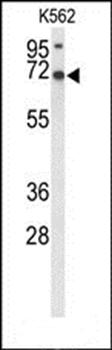 LRRC4 antibody