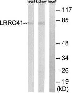 LRRC41 Antibody