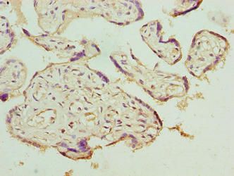 LRRC42 Antibody