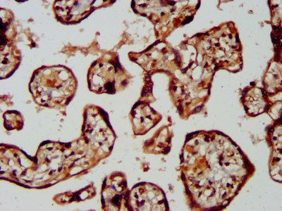 LRRC45 Antibody