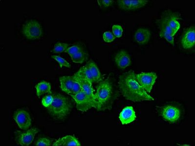 LRRC4C antibody