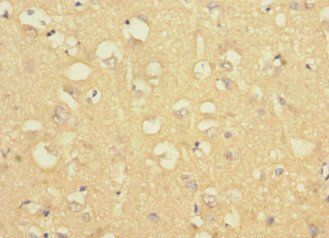 LRRC4C Antibody