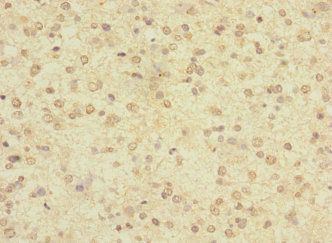 LRRC4C Antibody