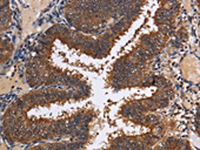 LRRC57 Antibody