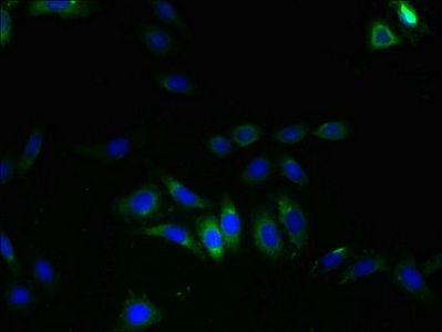 LRRC8E Antibody