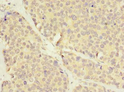 LRRC8E Antibody