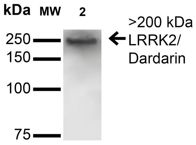 LRRK2 Antibody