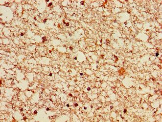 LRRK2 Antibody