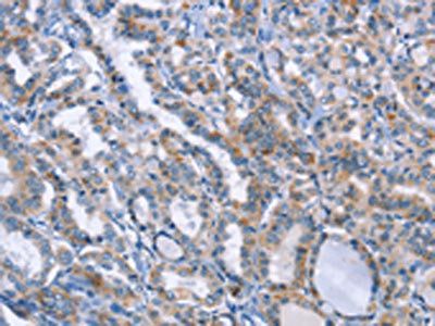 LRRK2 Antibody