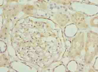 LRRN2 Antibody
