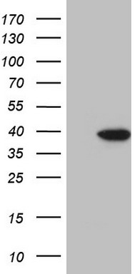 LRRTM1 Antibody