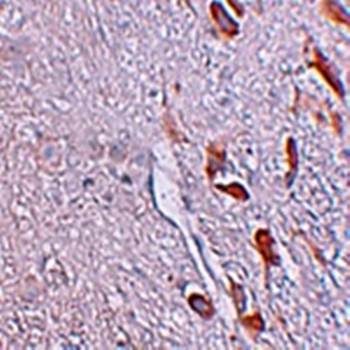 LRRTM1 Antibody