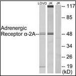 alpha 2a Adrenergic Receptor antibody [Out of stock]