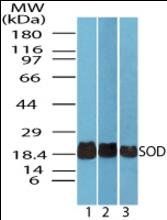 Superoxide Dismutase antibody [Out of stock]