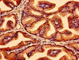 LSM1 Antibody