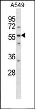 LSM14A antibody
