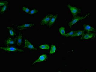 LSMEM1 Antibody