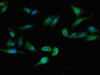 LSMEM1 antibody