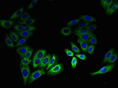 LSMEM2 Antibody