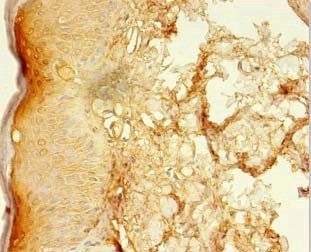 LSMEM2 Antibody