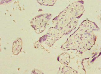 LSS Antibody