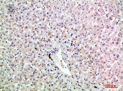 LTB Antibody