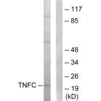 LTB antibody