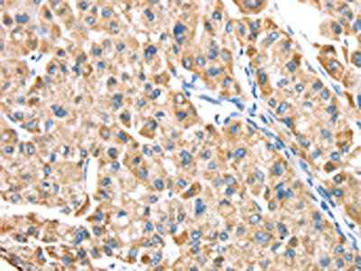LTB4R2 Antibody