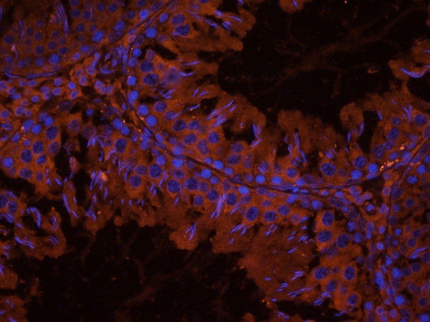 LTBP4 antibody