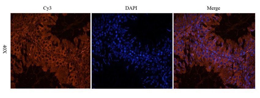 LTBP4 antibody