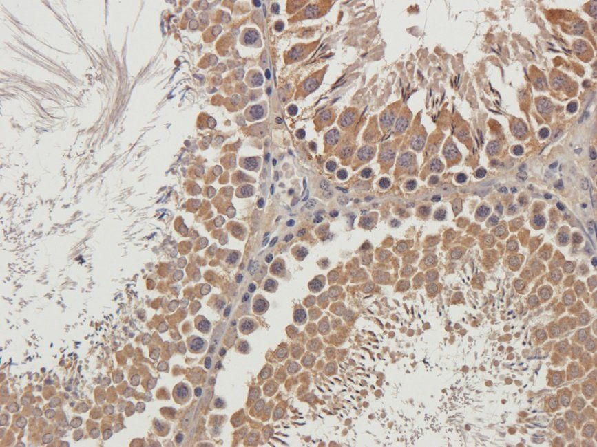 LTBP4 antibody