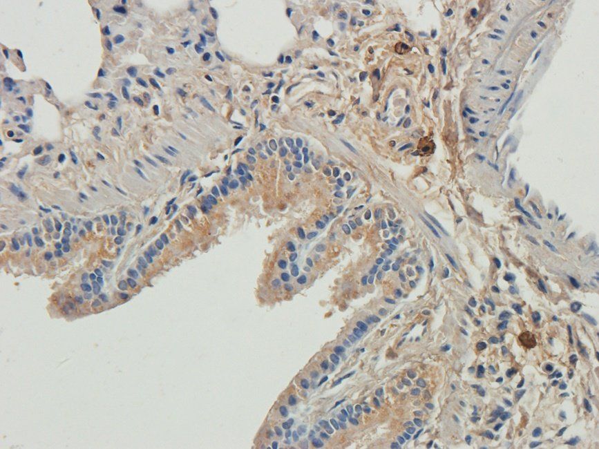 LTBP4 antibody