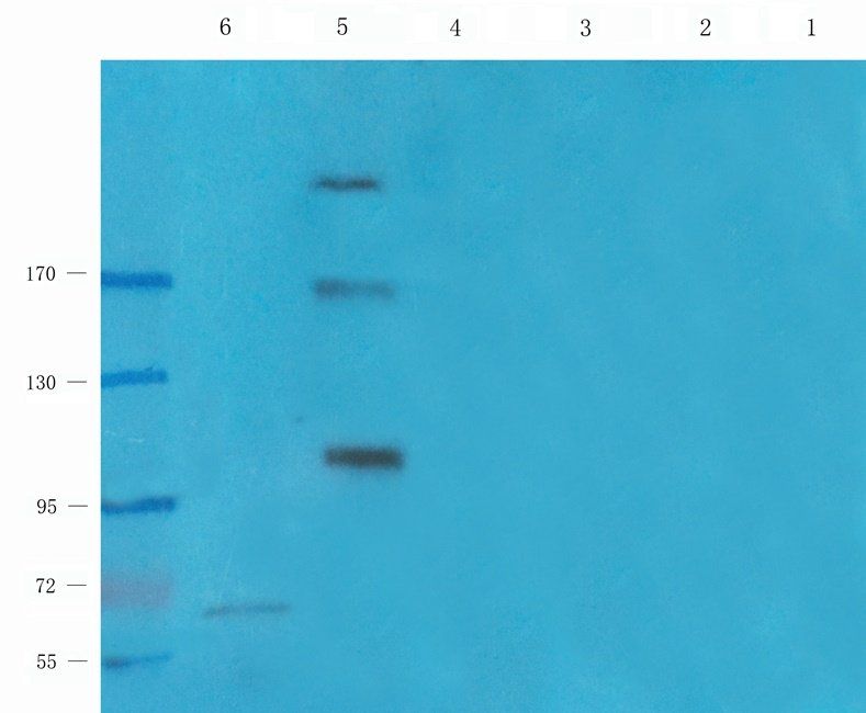 LTBP4 antibody