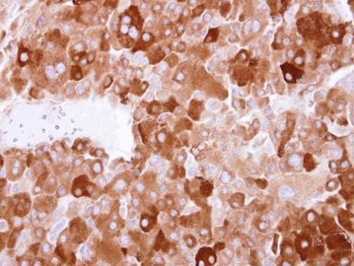 LTBP4 antibody [N1N2], N-term