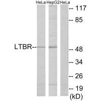 LTBR antibody