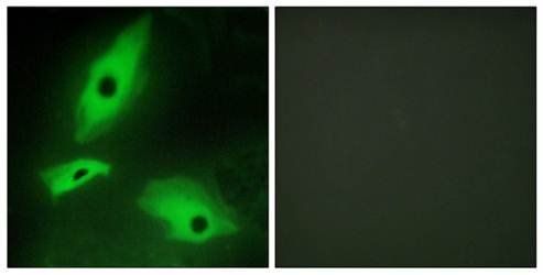 LTBR antibody