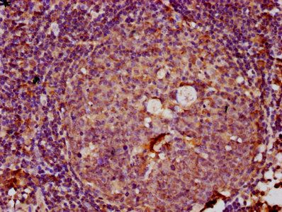LTN1 Antibody