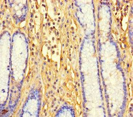 LTV1 Antibody