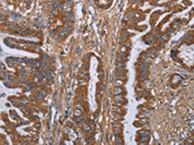 LUM Antibody