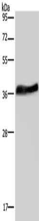 LUM antibody