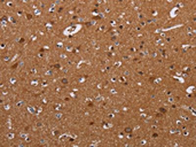LUM Antibody