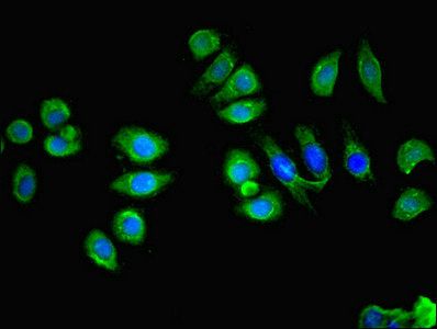 LY6E antibody