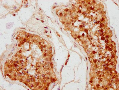 LY6K Antibody