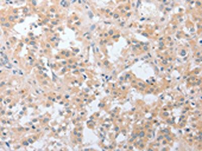 LY96 antibody