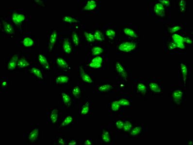 LYAR Antibody