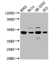 LYAR antibody