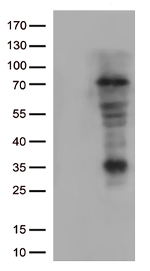 LAG3 Antibody
